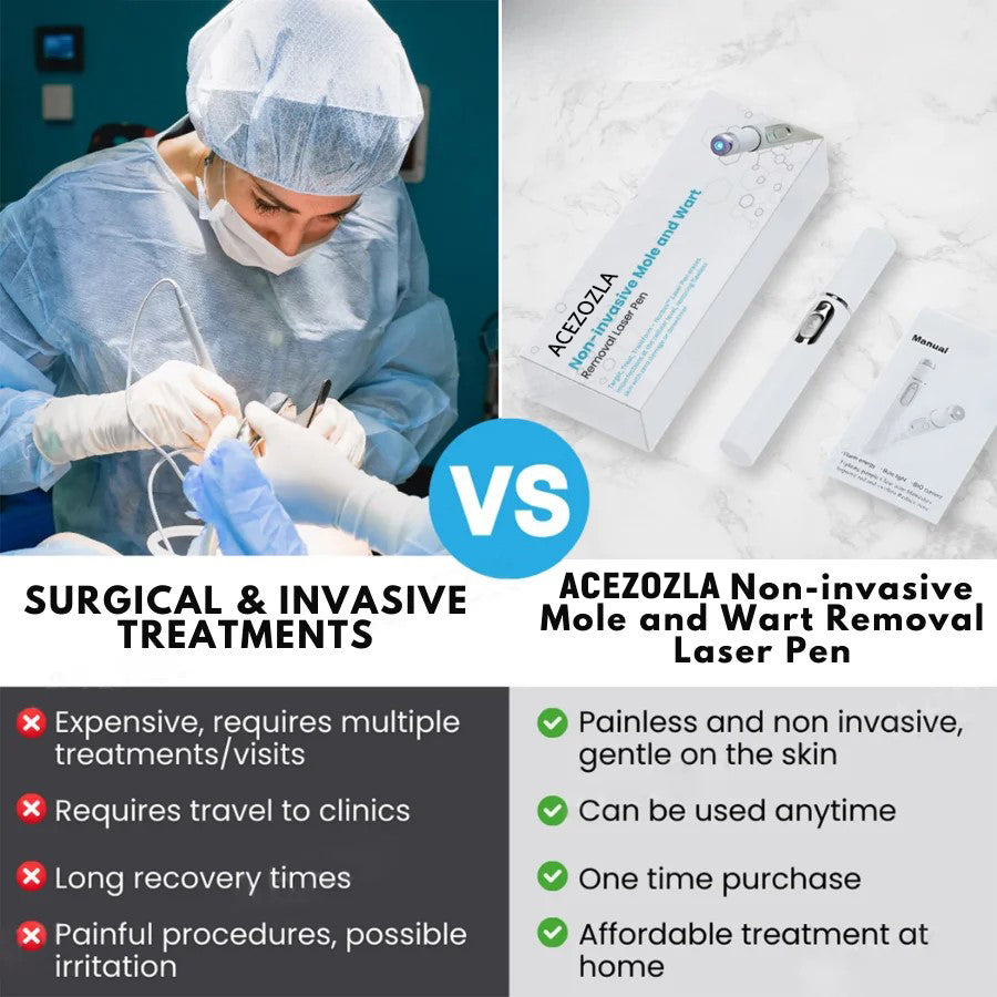 Say goodbye to moles and skin tags! ACEZOZLA™ non-invasive laser pen delivers hospital-grade results at home