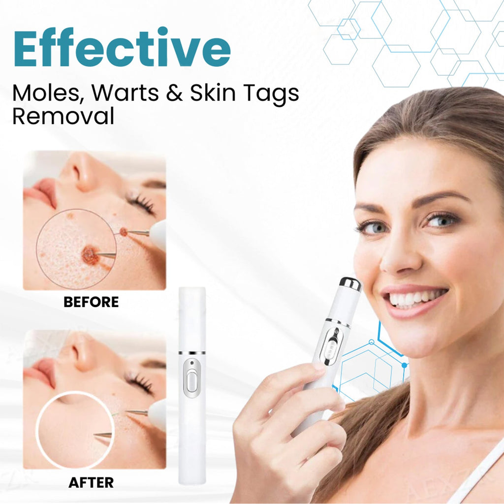 Say goodbye to moles and skin tags! ACEZOZLA™ non-invasive laser pen delivers hospital-grade results at home