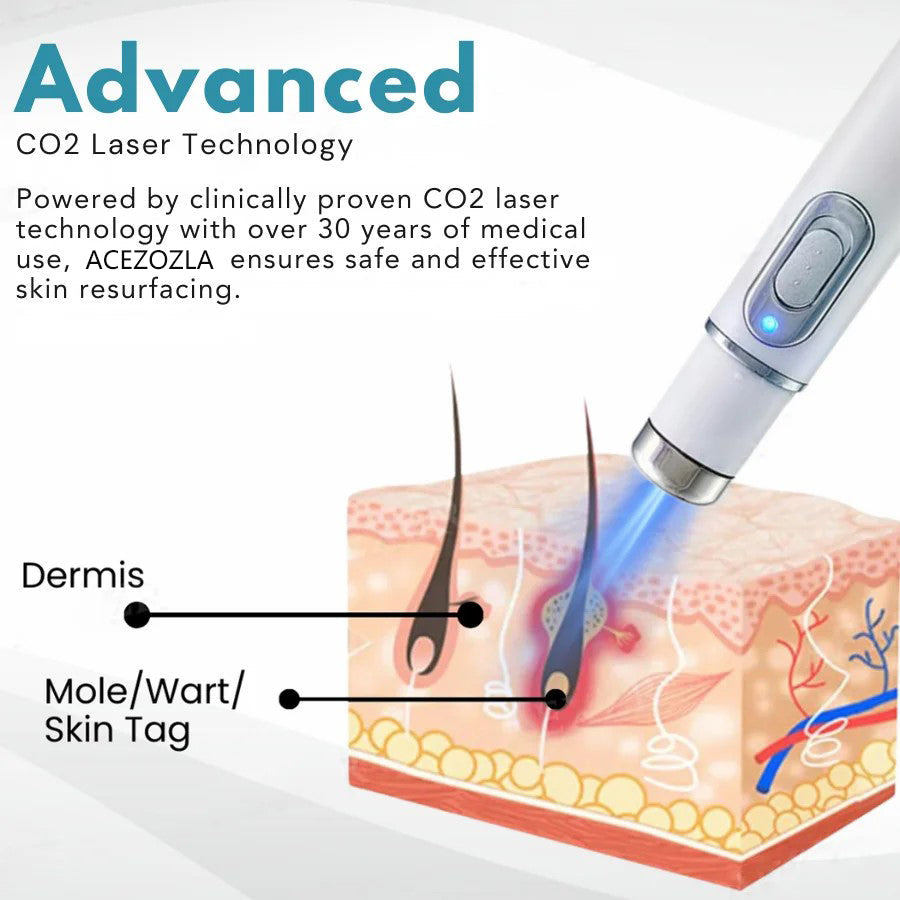 Say goodbye to moles and skin tags! ACEZOZLA™ non-invasive laser pen delivers hospital-grade results at home